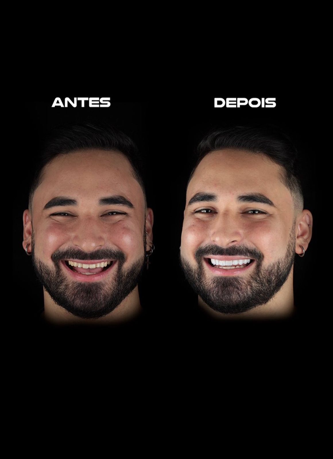 Paciente Antes e Depois