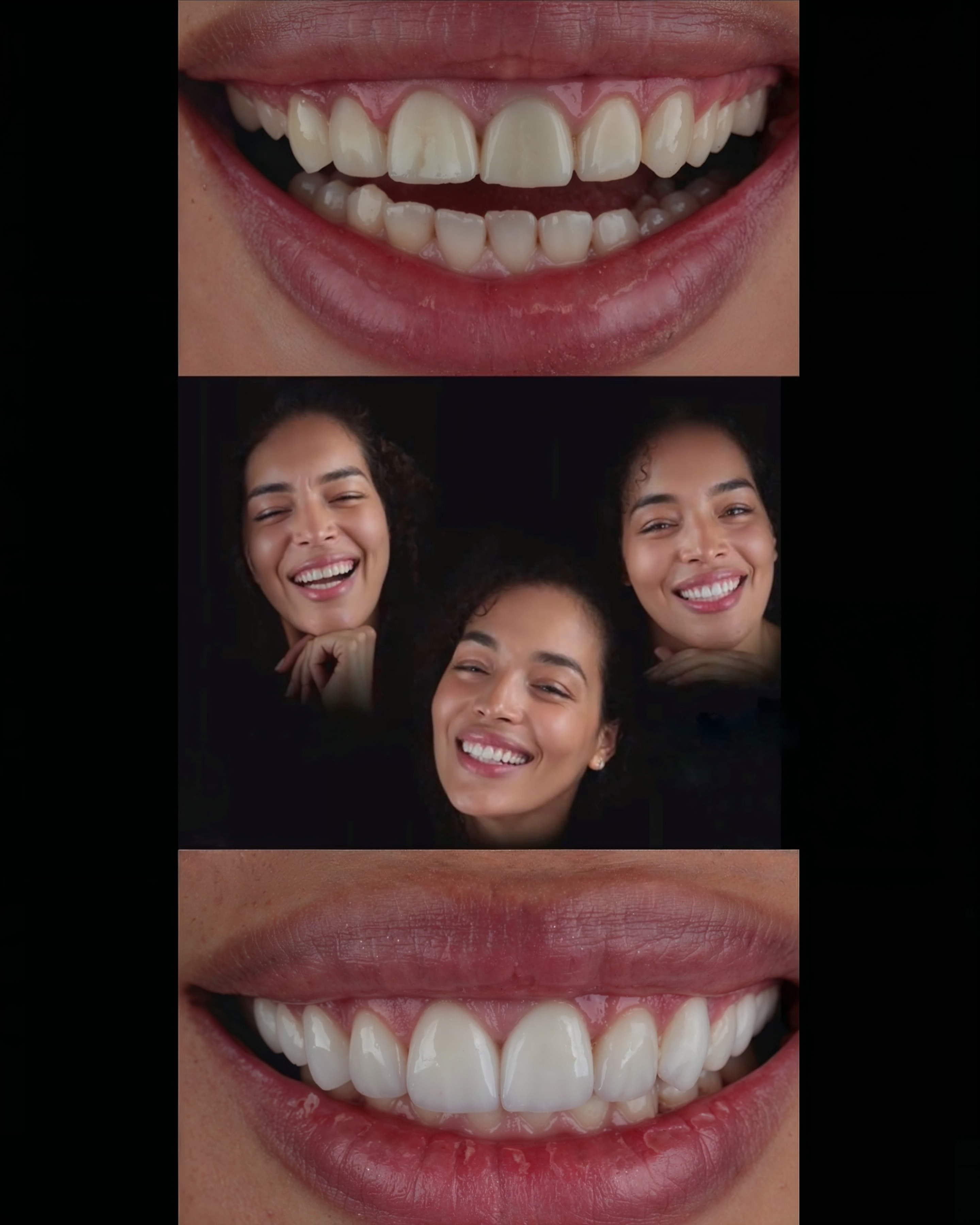 Paciente Antes e Depois