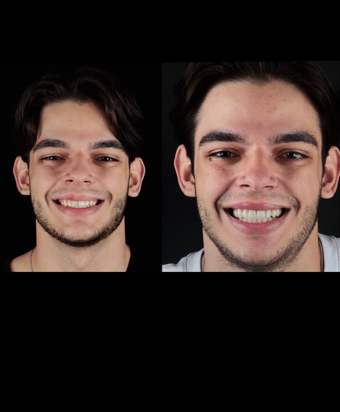 Paciente Antes e Depois