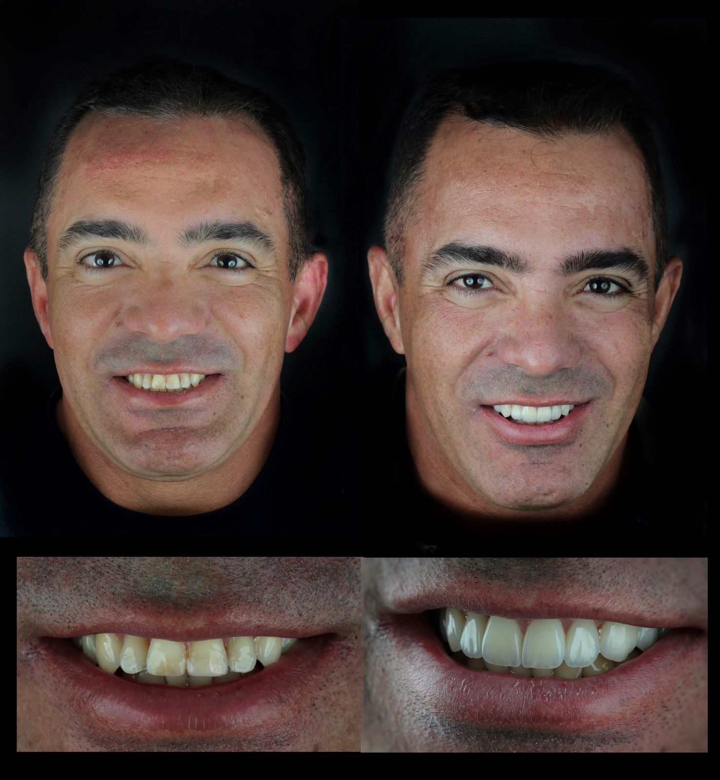 Paciente Antes e Depois