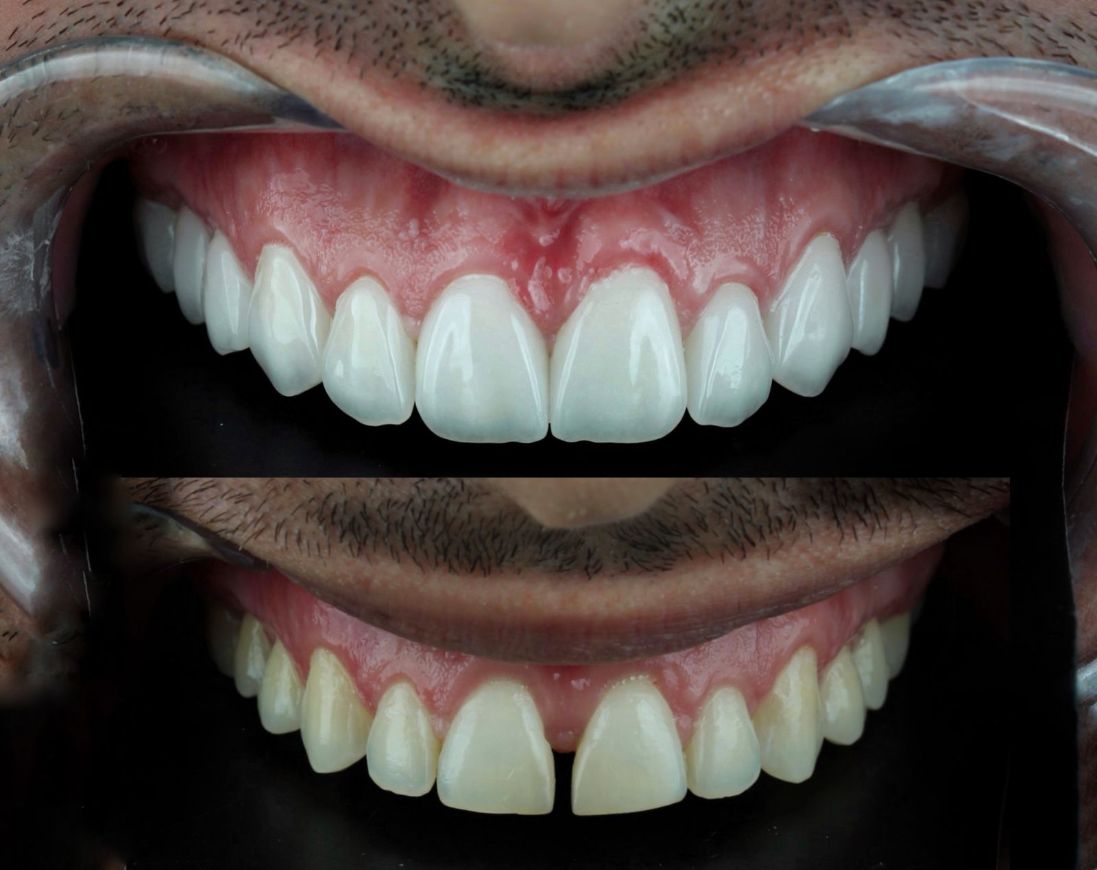 Paciente Antes e Depois