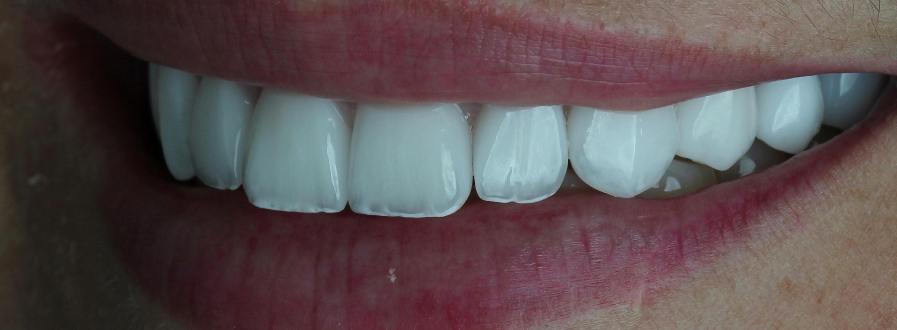 Paciente Antes e Depois