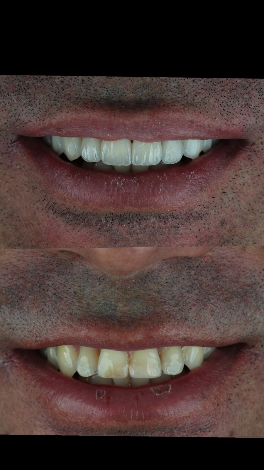 Paciente Antes e Depois
