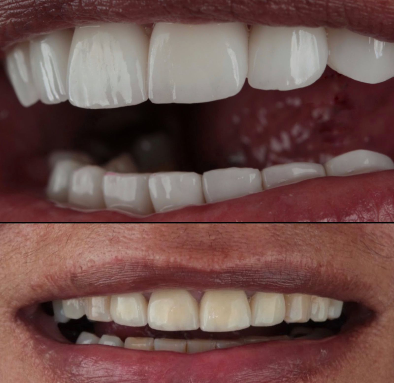 Paciente Antes e Depois