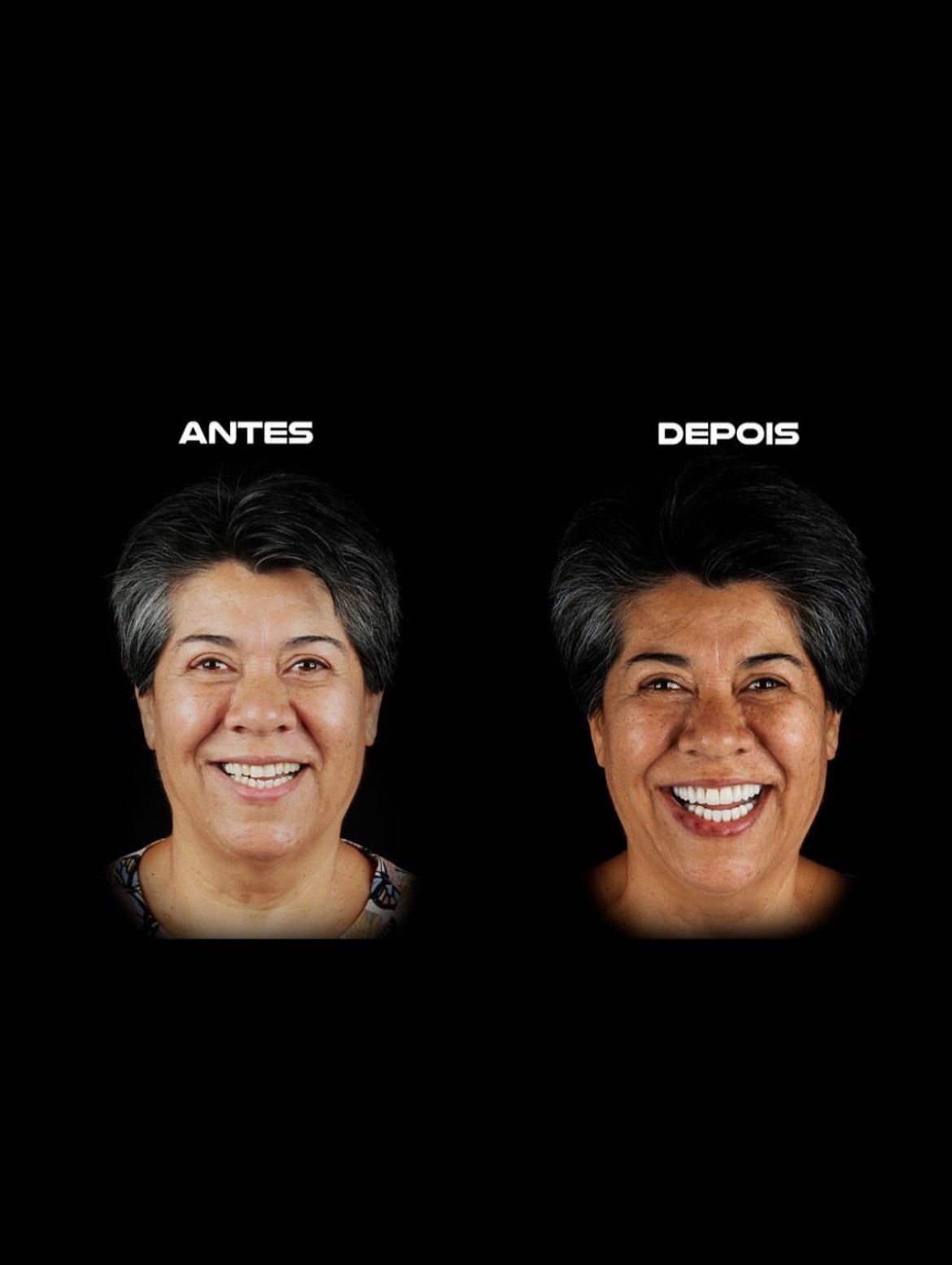 Paciente Antes e Depois